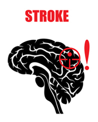 Stroke Awareness and Prevention